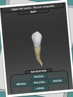 CavSim : Dental Cavity Trial screenshot 1