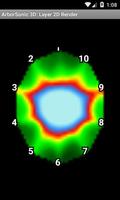 ArborSonic 3D ภาพหน้าจอ 1