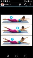 Slipped Disc Exercise Affiche