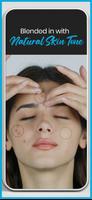 Pimple remover - Acne eraser اسکرین شاٹ 1
