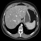 abdominal CT: annotated slices icon