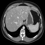 abdominal CT: annotated slices