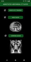 abdominal CT: annotated slices poster