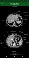 abdominal CT: annotated slices screenshot 2