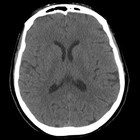 Brain CT : annotated slices আইকন