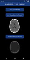 پوستر Brain CT : annotated slices