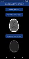 Brain CT : annotated slices পোস্টার