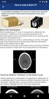 Brain CT : annotated slices স্ক্রিনশট 1
