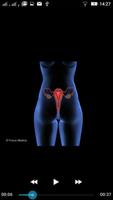 Gynecology-Animated Dictionary syot layar 3