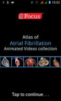 Atlas of Atrial Fibrillation ポスター