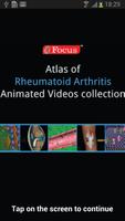 Atlas of Rheumatoid Arthritis gönderen