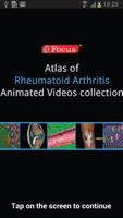 Atlas of Rheumatoid Arthritis Cartaz