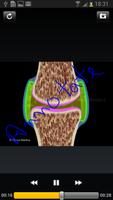 Atlas of Rheumatoid Arthritis screenshot 2