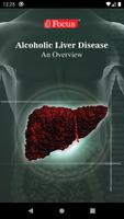 Alcoholic Liver Disease Cartaz