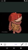 Alcoholic Liver Disease imagem de tela 2