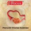 Polycystic Ovarian Syndrome