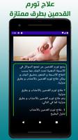 امراض القدم وطرق علاجها ảnh chụp màn hình 2