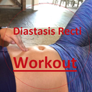 APK Diastasis Recti Workout