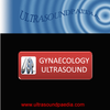 Gynecology Ultrasound Mod apk أحدث إصدار تنزيل مجاني