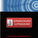 Gynecology Ultrasound APK