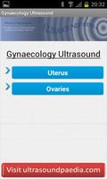 Gynecology Ultrasound bài đăng