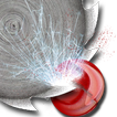 Accelerometer Ball