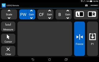 LOGIQ Remote Screenshot 1