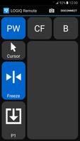 LOGIQ Remote Screenshot 2