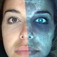 DermIA  - 使用手机相机分析皮肤癌斑点，使用人工智能分析您的皮肤和斑点 截圖 3