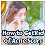 How to Get Rid of Pimple Scars