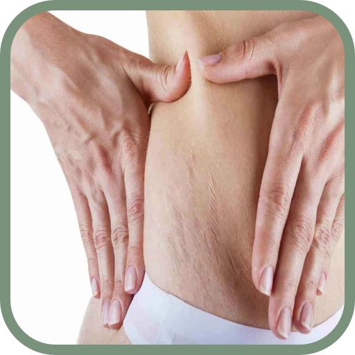 Adeus Estrias - Receitas caseiras é Dicas