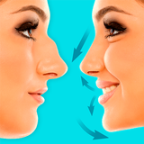 Rhinoplasty: Chỉnh sửa mũi