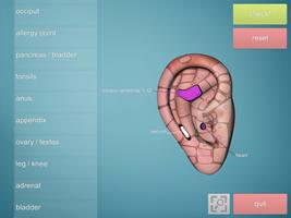 Drag&Drop Reflexology- ears screenshot 1