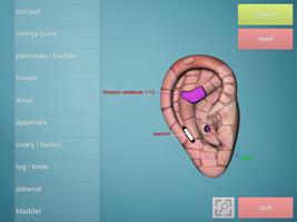 Drag&Drop Reflexology- ears screenshot 2