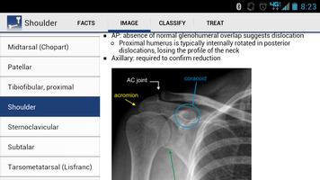 Ortho Traumapedia imagem de tela 2