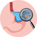 روش های درمان زخم معده