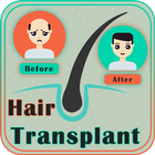 Hair Transplant icône