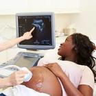 Ultrasound Video 图标