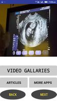 Ultrasound Video 截图 2