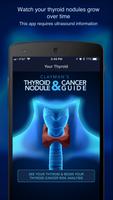 Thyroid Nodule and Cancer Guid پوسٹر