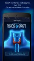 Thyroid Nodule and Cancer Guid Affiche