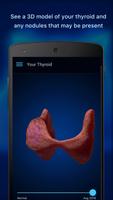 Thyroid Nodule and Cancer Guid स्क्रीनशॉट 1