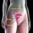Female Impotence