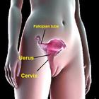 Female Impotence иконка
