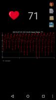 Moniteur Heartbeat capture d'écran 2