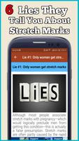 How To Get Rid Of Stretch Marks With Home Remedies постер