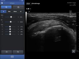 SONON screenshot 1