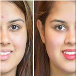 Get Smooth Skin and good health