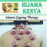 Cupping Therapy Affiche