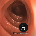 Anal canal Anatomy Health Info